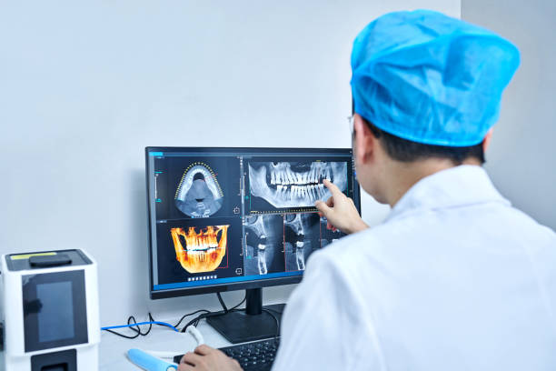 Best Emergency Dentist for Knocked-Out Tooth in White City, FL